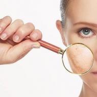 Косметологические препараты и лечебная косметика для лица в аптеках, медицинский крем и лекарство для проблемной кожи Особенности лечебной косметики для волос
